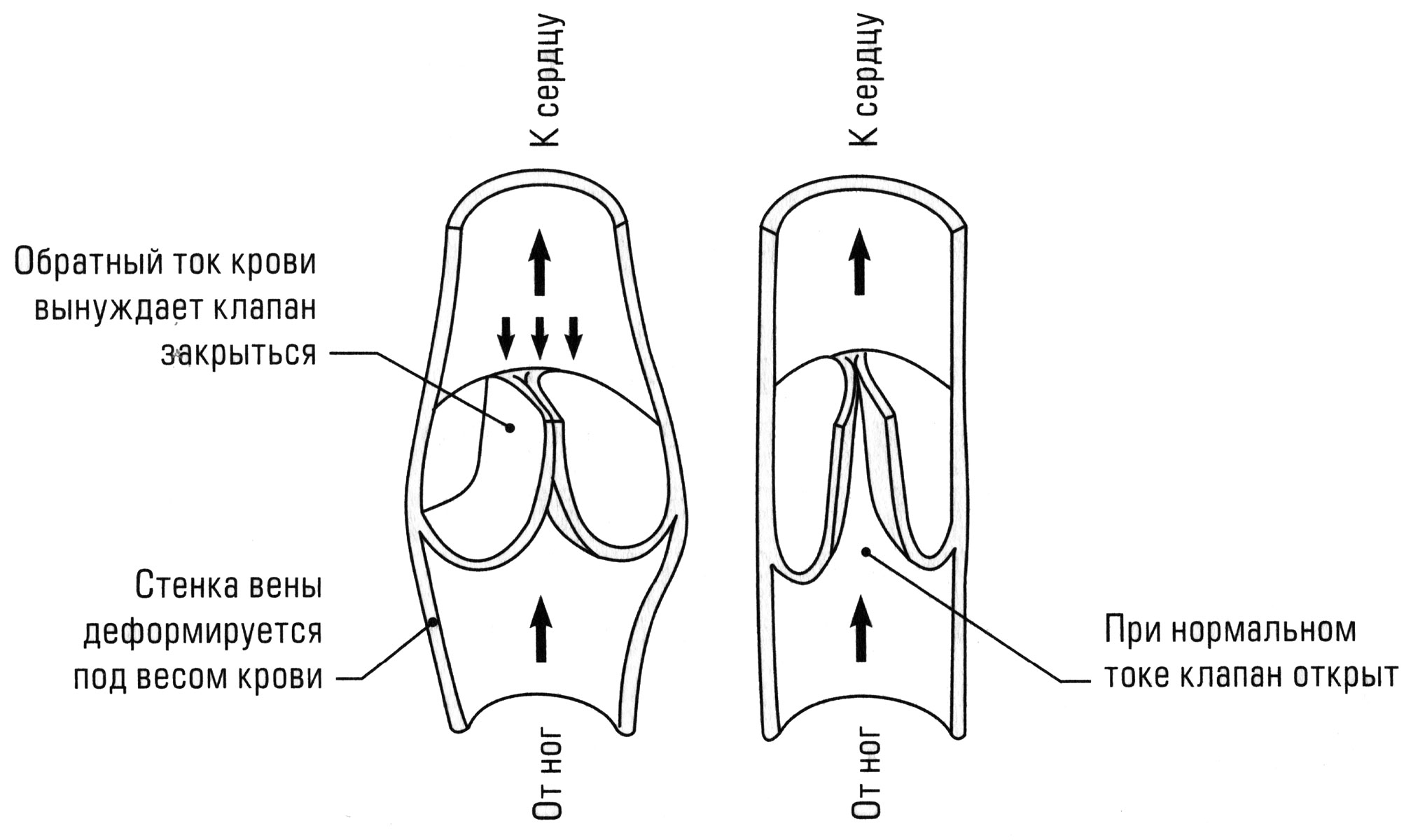 Что делают венозные клапаны