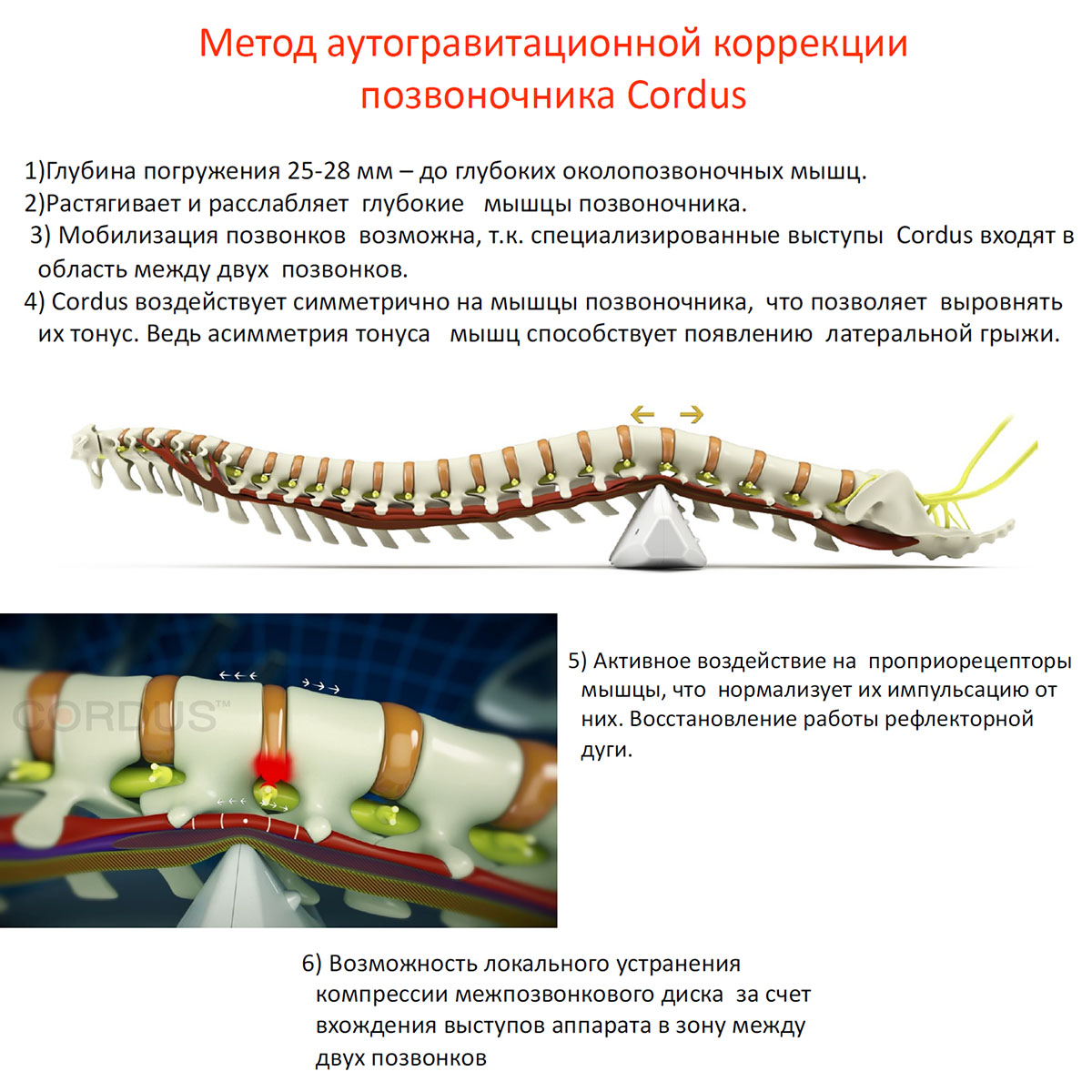 Массажеры, тренажеры и аппликаторы.: Cordus и Sacrus